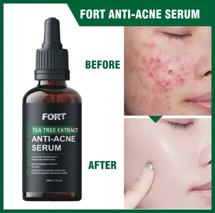 Anti-Acne & Dark Spot Face Serum